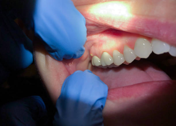 Best Emergency Orthodontic Repairs in Oblong, IL
